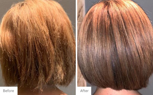 5 - Before and After Real Results picture of a woman's hair.